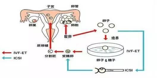 捐卵给多少钱